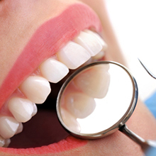 Tooth Whitening  in rohini sector 15